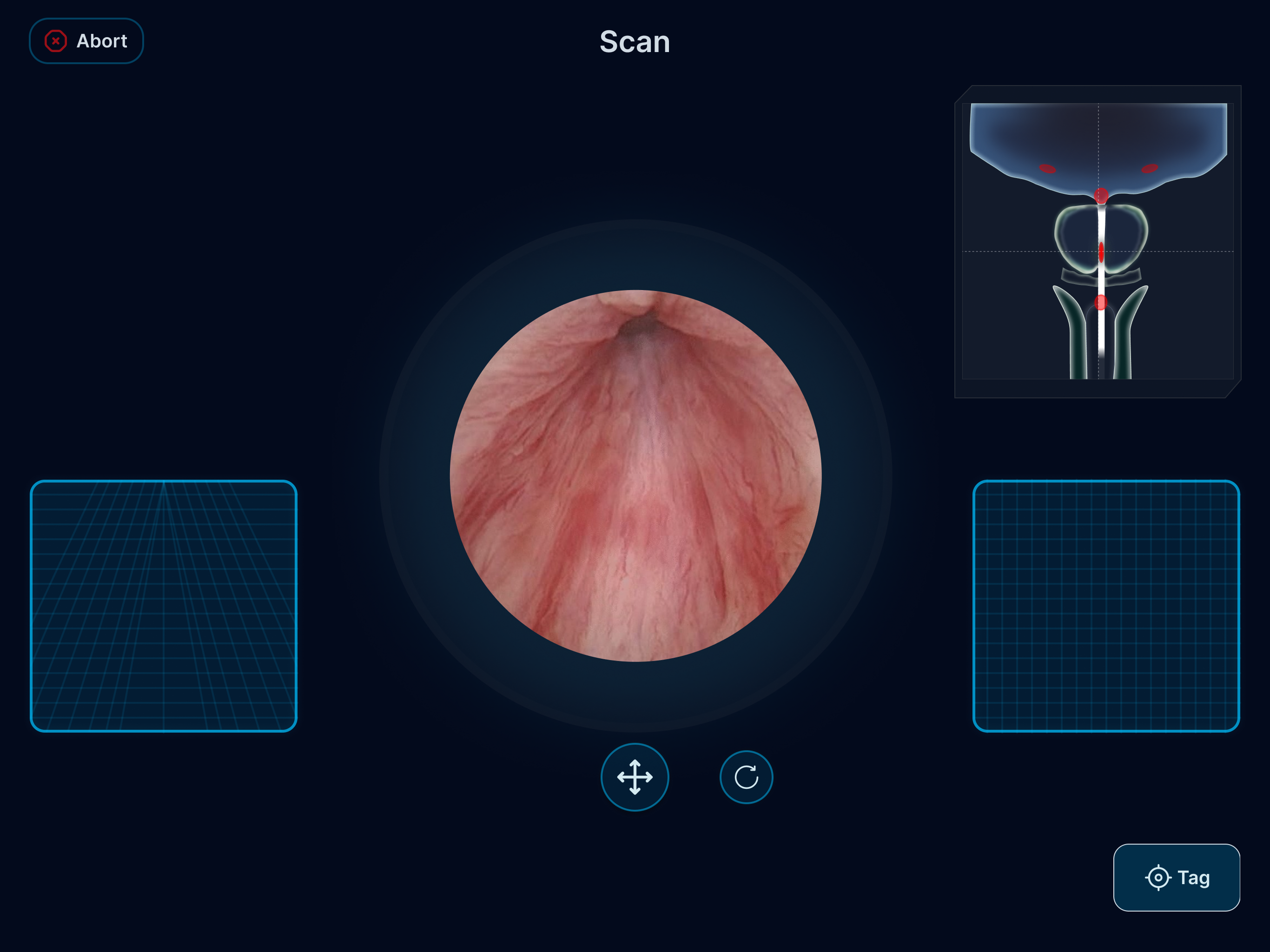 Autonomous surgical interface preview